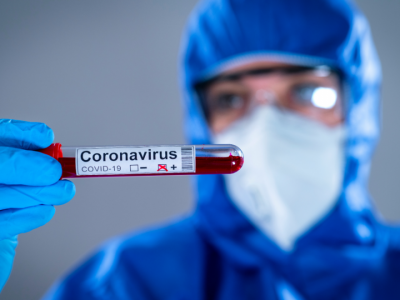 Covid-19: semana inicia com 181 casos positivos, marca recorde da pandemia em Candelária