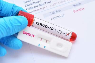 Covid 19: boletim da sexta notifica mais 44 novos contaminados