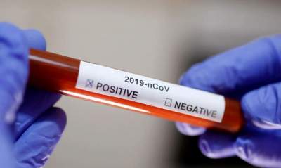 Coronavírus: Candelária tem 13 casos confirmados
