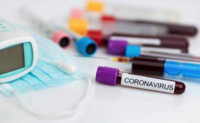 Coronavírus: além dos testes negativos, Candelária não tem casos suspeitos desde o dia 29