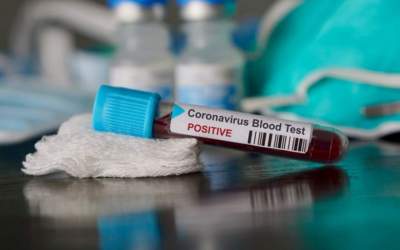 Candelária tem segundo caso confirmado de coronavírus