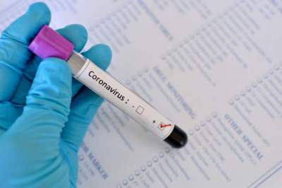 Coronavírus: jovem de 19 anos é o mais recente infectado em Candelária