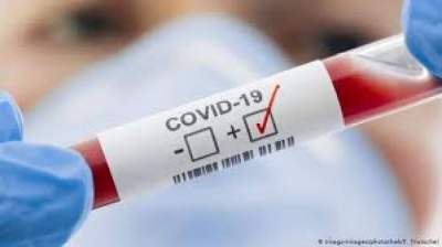 Candelária confirma 67 novos casos de covid-19