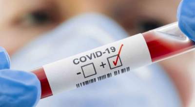 Covid-19: boletim de segunda indica dois novos casos 
