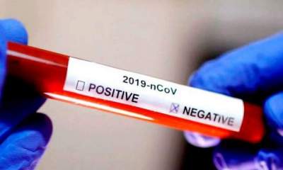 Coronavírus: Segunda com poucos atendimentos e mais nove testes negativos