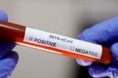 Novo Cabrais confirma primeiro caso de coronavírus 