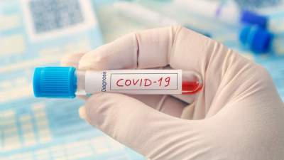 Novos casos de Coronavírus são quatro homens e três mulheres